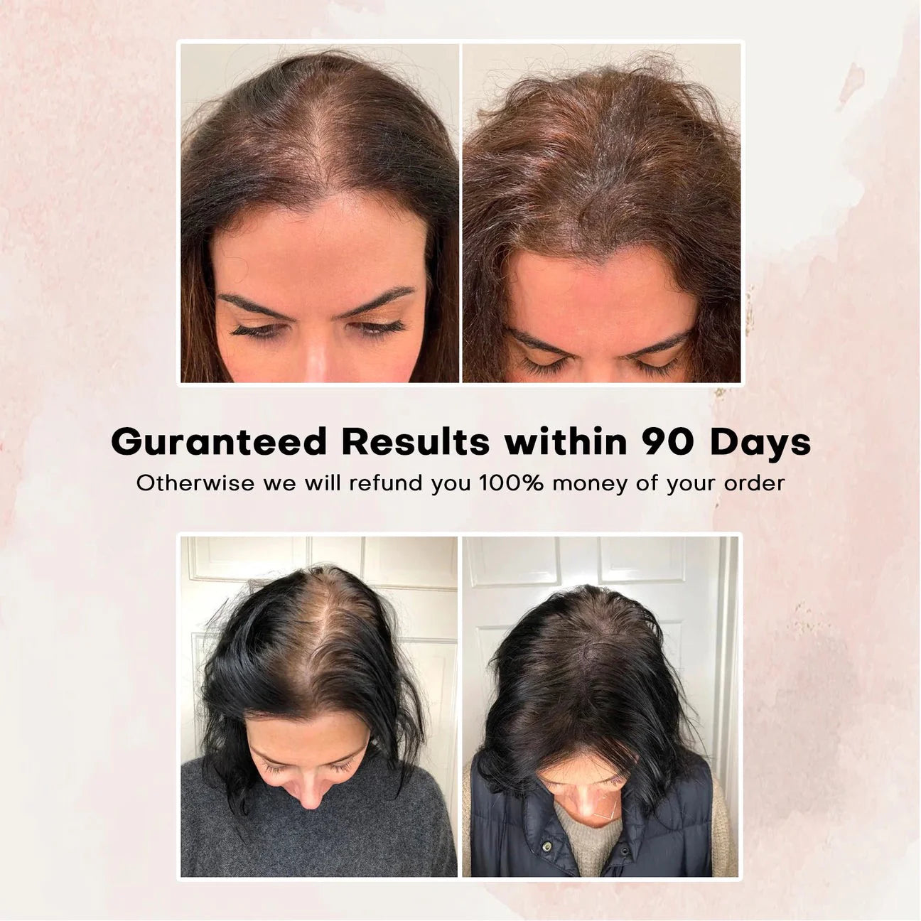 Bevalora™ 4-in-1 Scalp & Hair Growth Brush
