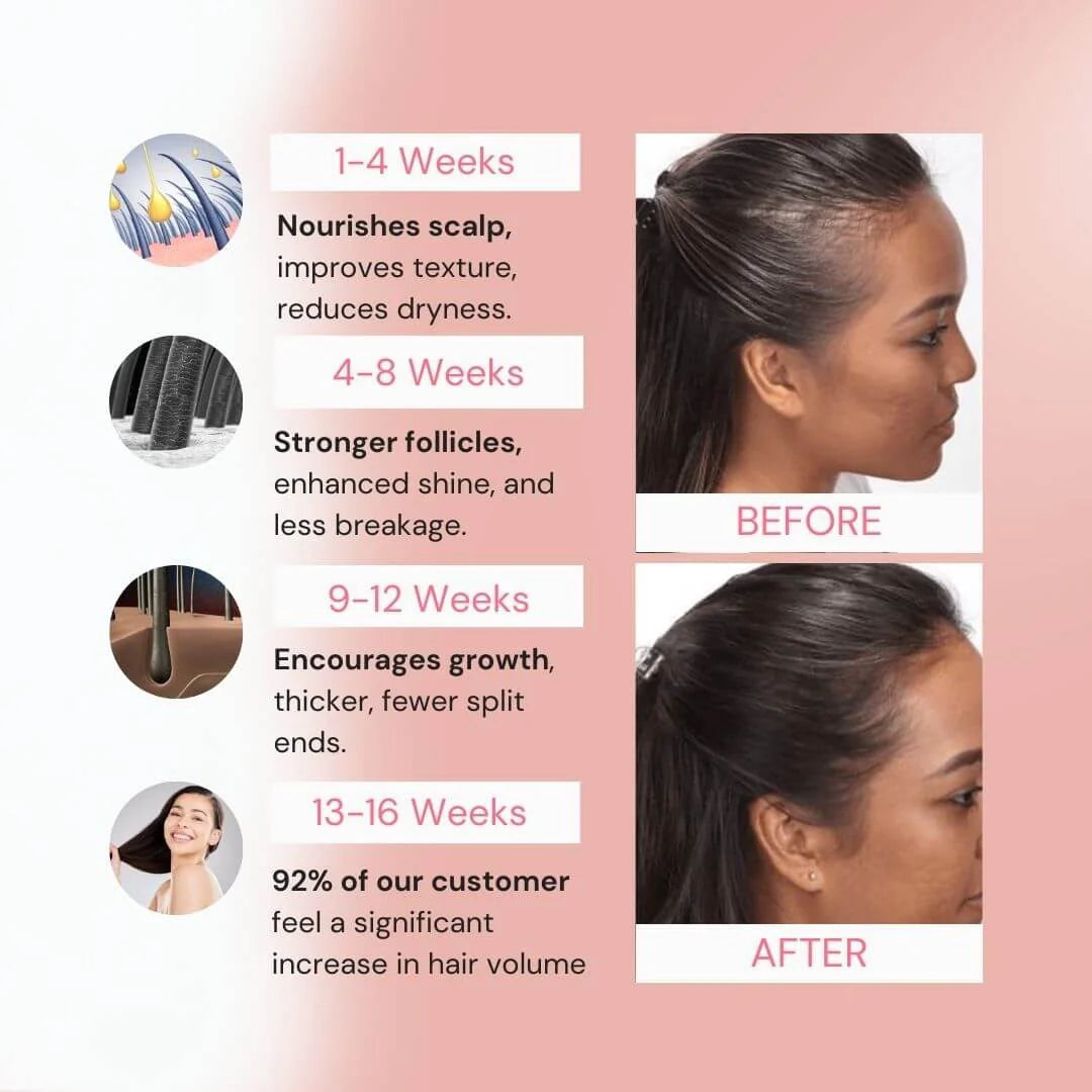 Bevalora™ 4-in-1 Scalp & Hair Growth Brush