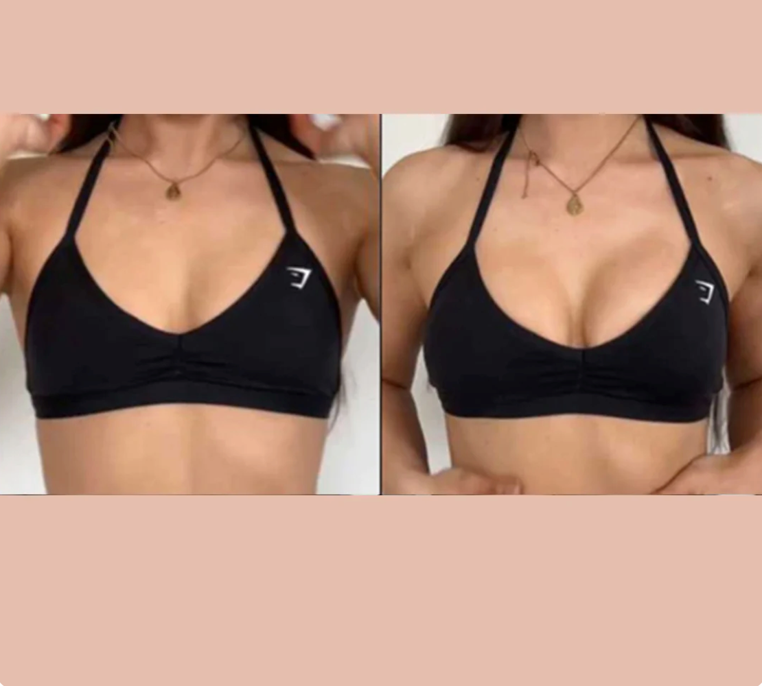 Bevalora™ sticky CAKES circles - The first-ever "sticky" not icky circle nipple covers