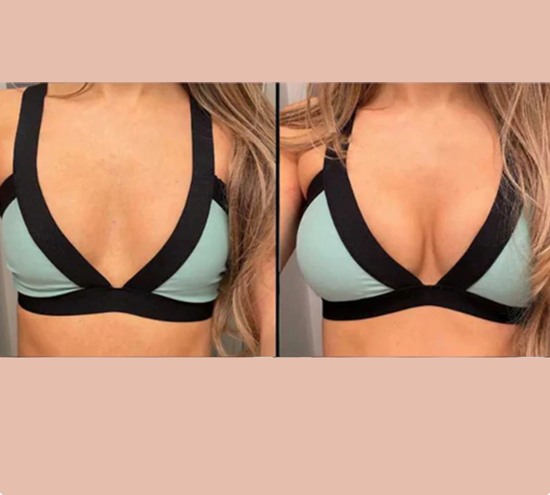Bevalora™ sticky CAKES circles - The first-ever "sticky" not icky circle nipple covers