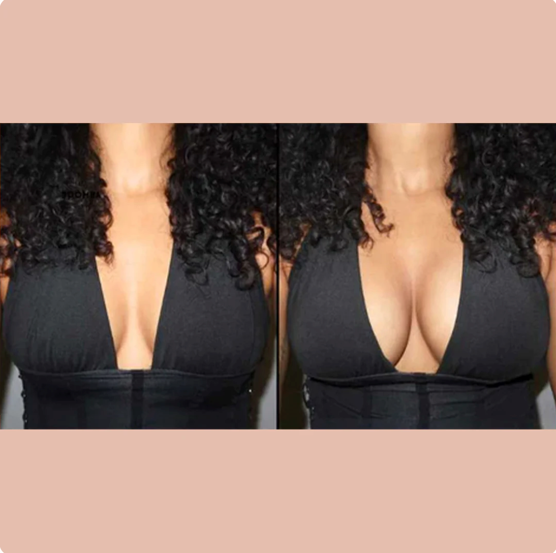 Bevalora™ sticky CAKES circles - The first-ever "sticky" not icky circle nipple covers