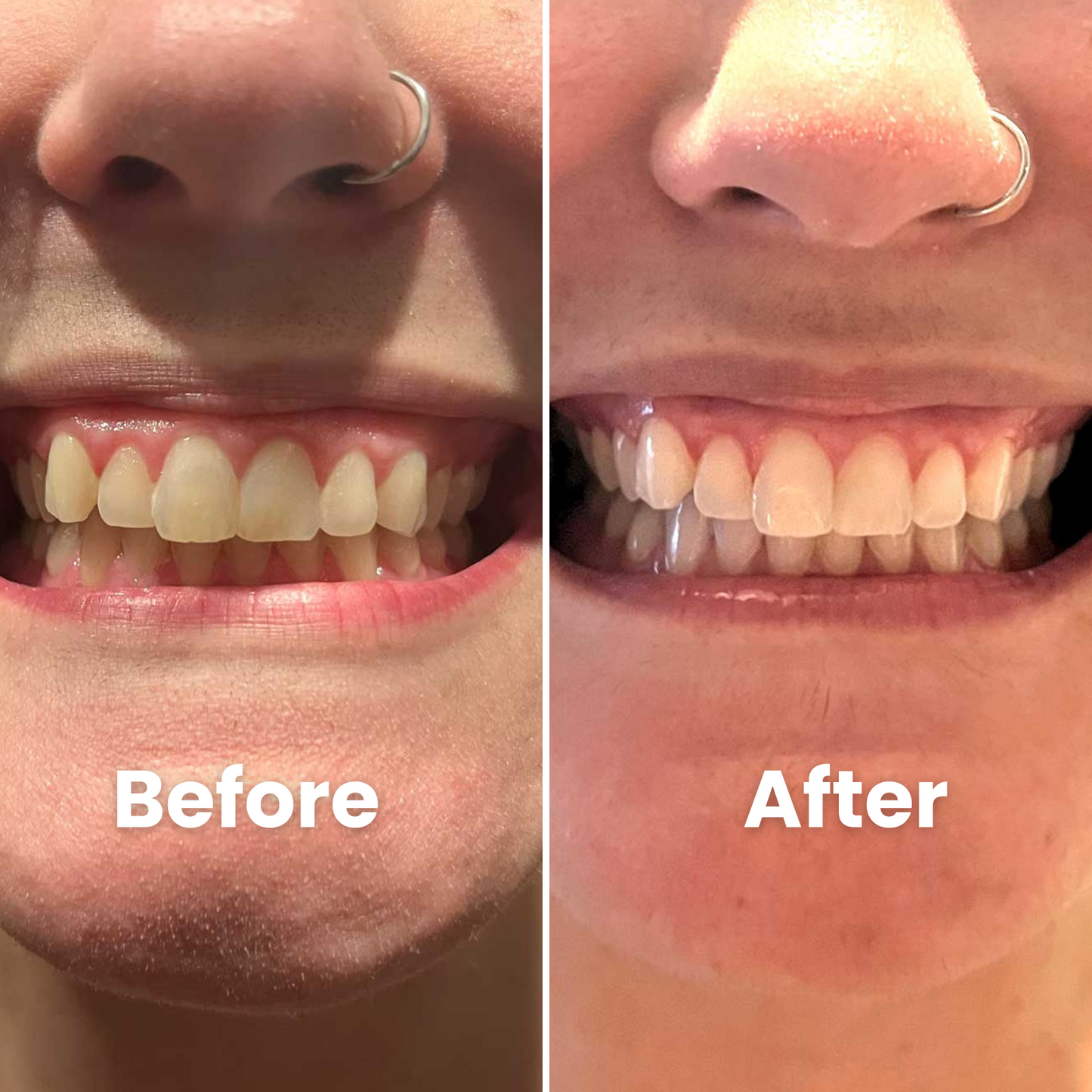 Bevalora™ Smiles Teeth Brightening Powder