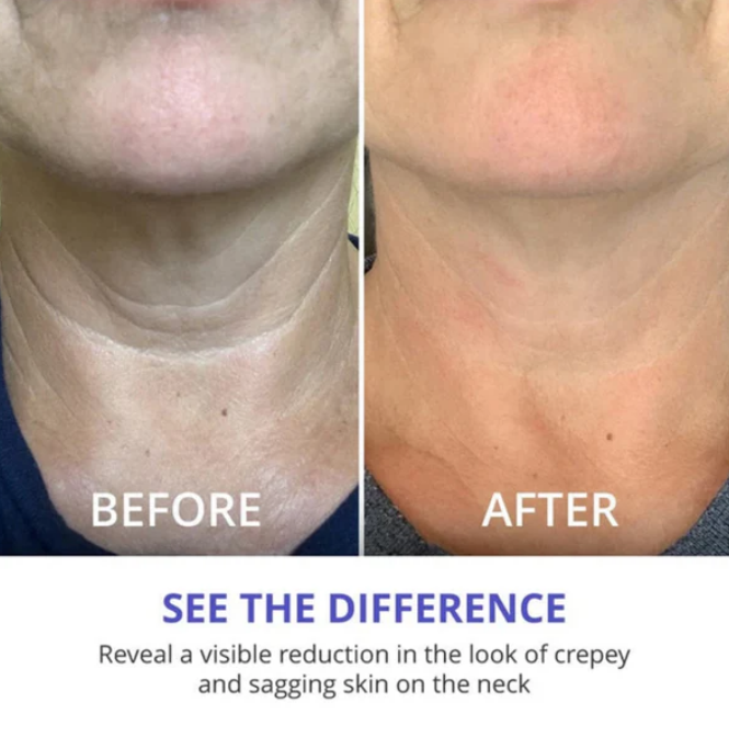Bevalora™ Pro-Natural Face Lifter