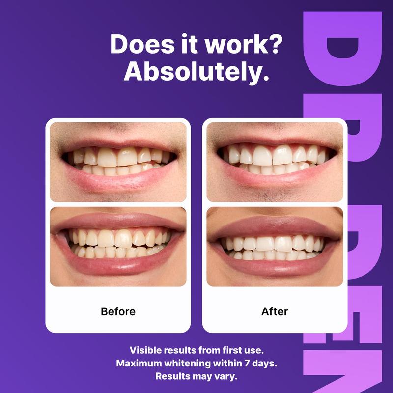 Bevalora® Teeth Whitening Strips