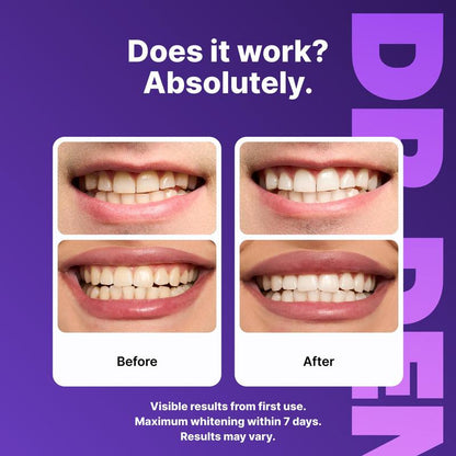 Bevalora® Teeth Whitening Strips