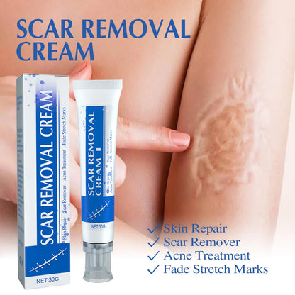 Bevalora® – Scar Removal Repair Cream for Men and Women
