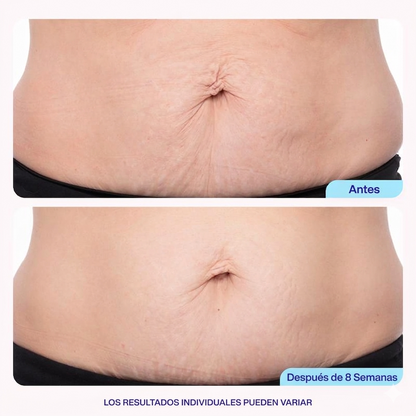 Bevalora® Firma & Reafirma Crema Corporal