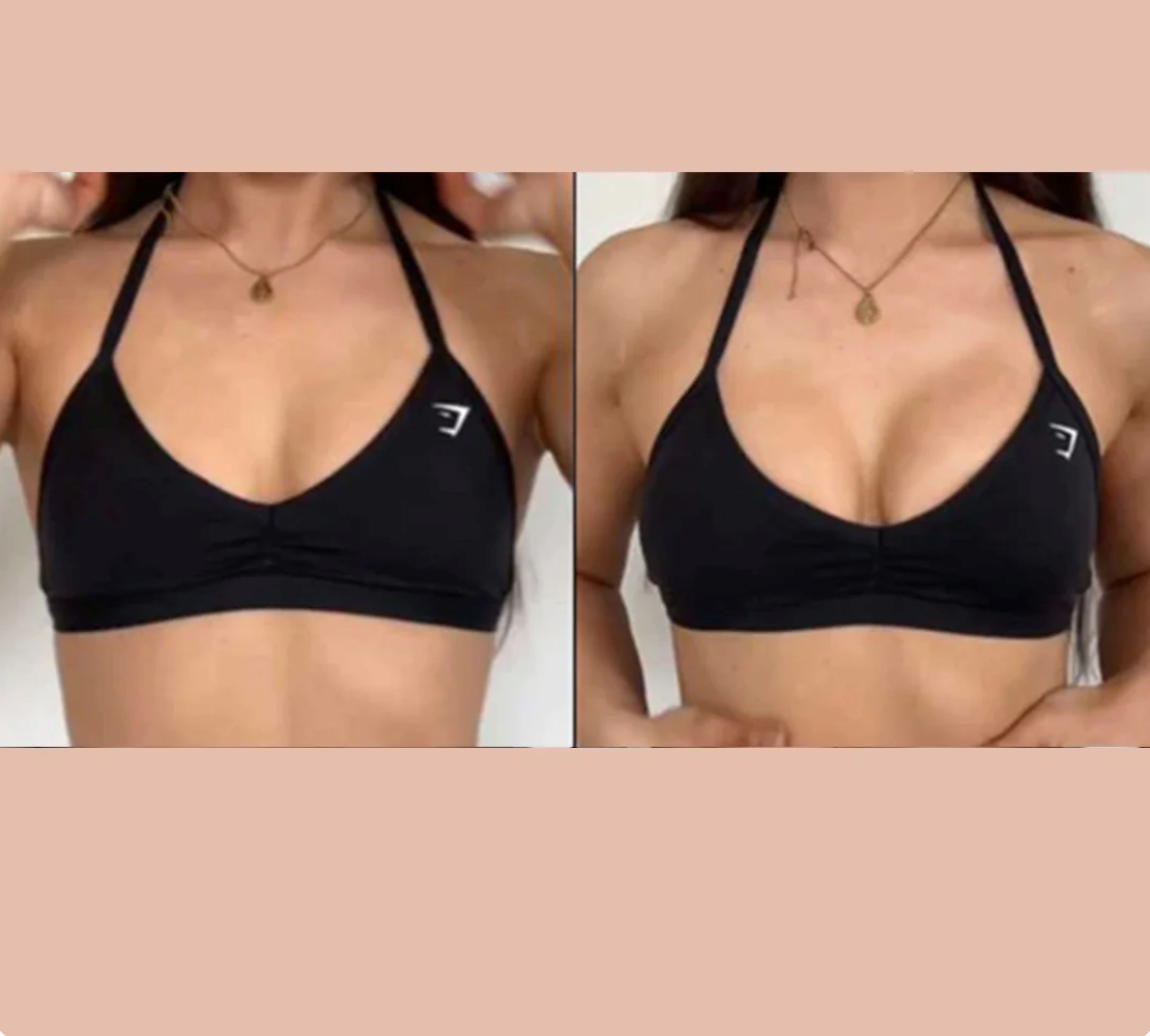 Bevalora™ Ultra-Lift Sticky Bra