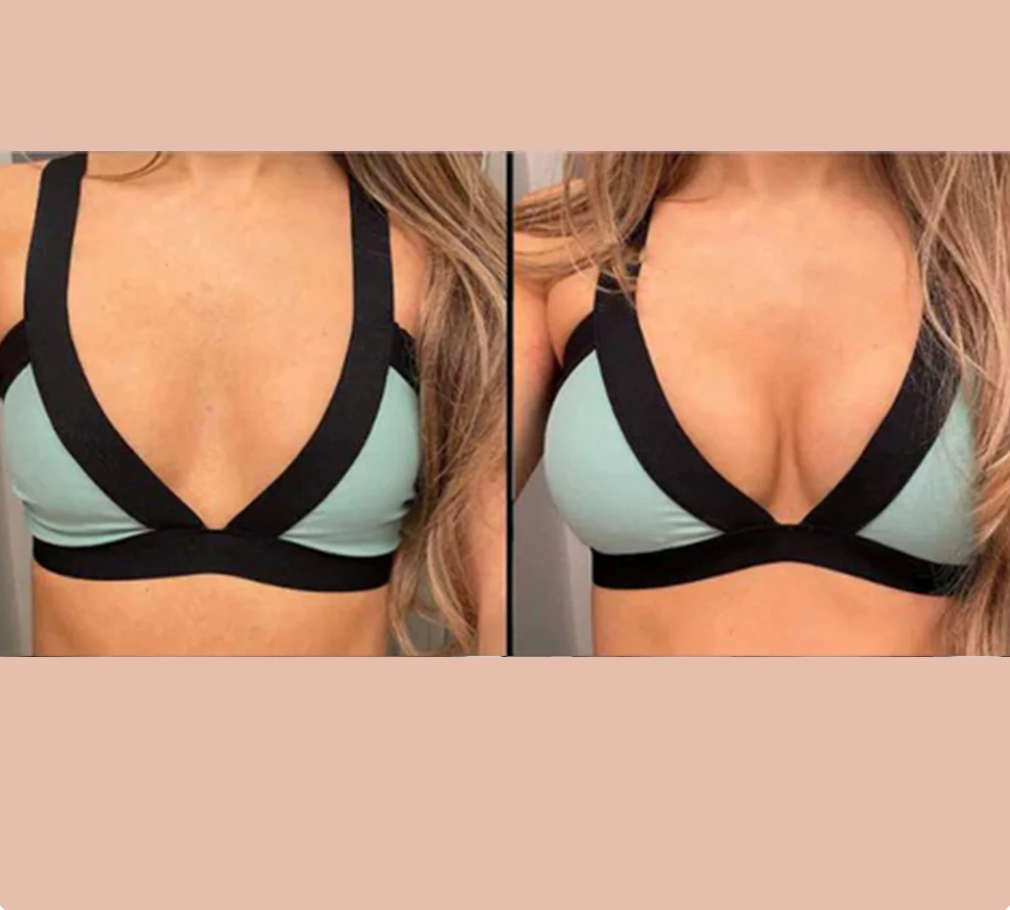 Bevalora™ Ultra-Lift Sticky Bra