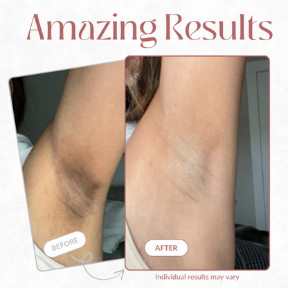 Bevalora® Peel Shot – Kojic + Turmeric Body Peel Spray