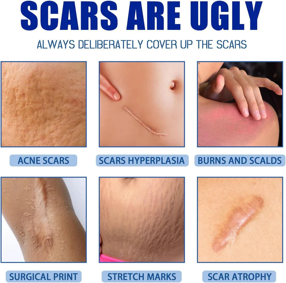 Bevalora® – Scar Removal Repair Cream for Men and Women