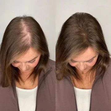 Bevalora® - Rosemary Hair Growth Shampoo