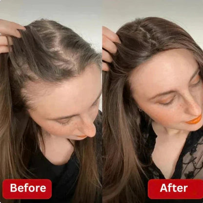 Bevalora® - Rosemary Hair Growth Shampoo