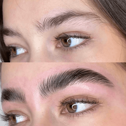 Bevalora™ Effortless Brow Lift Set