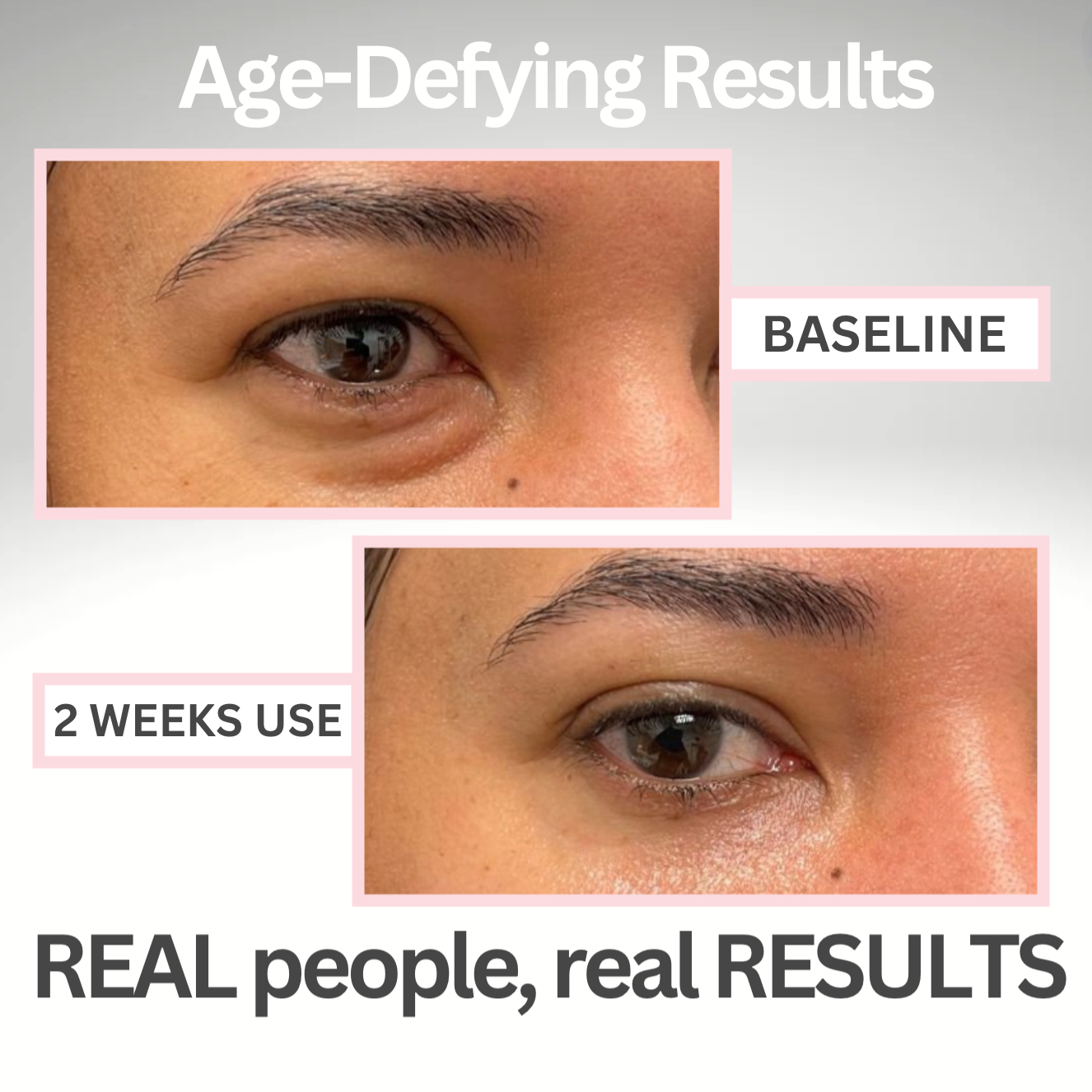 Bevalora™ Youthful Radiance Eye Serum